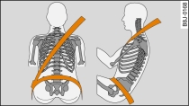 Colocacin de la banda del hombro y de la banda abdominal
